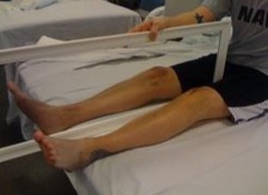 Дзеркальна терапія